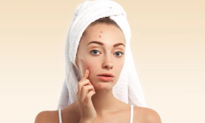 Acne & Oil Control